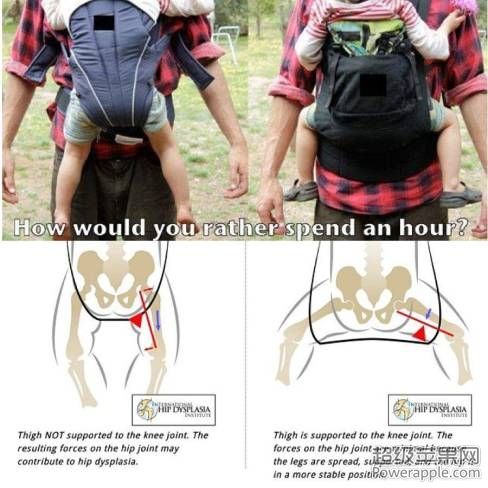 hip-dysplasia.jpg